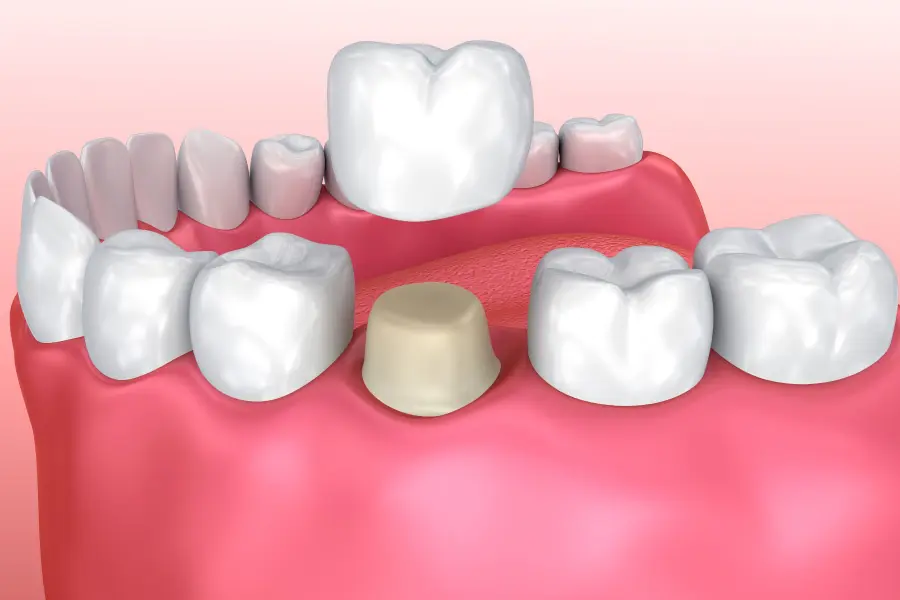 Medications & Oral Health