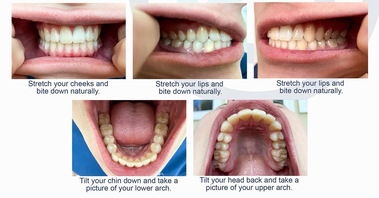 Photo guide for dental consultation