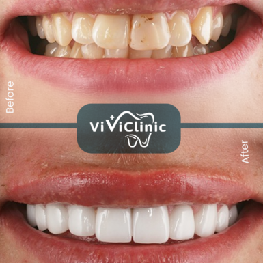 before-after-gallery-2