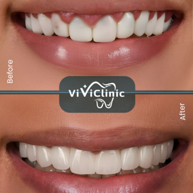 before-after-gallery-3