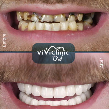 before-after-gallery-5