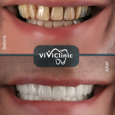 before-after-gallery-6