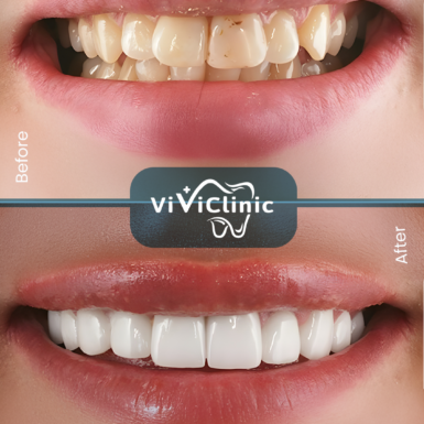 before-after-gallery-8