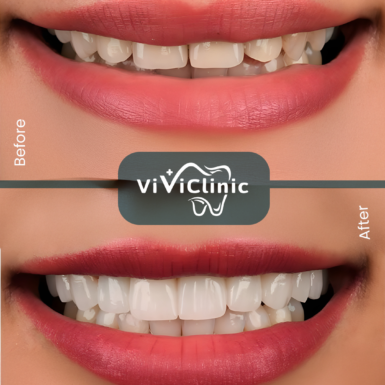 before-after-gallery-9